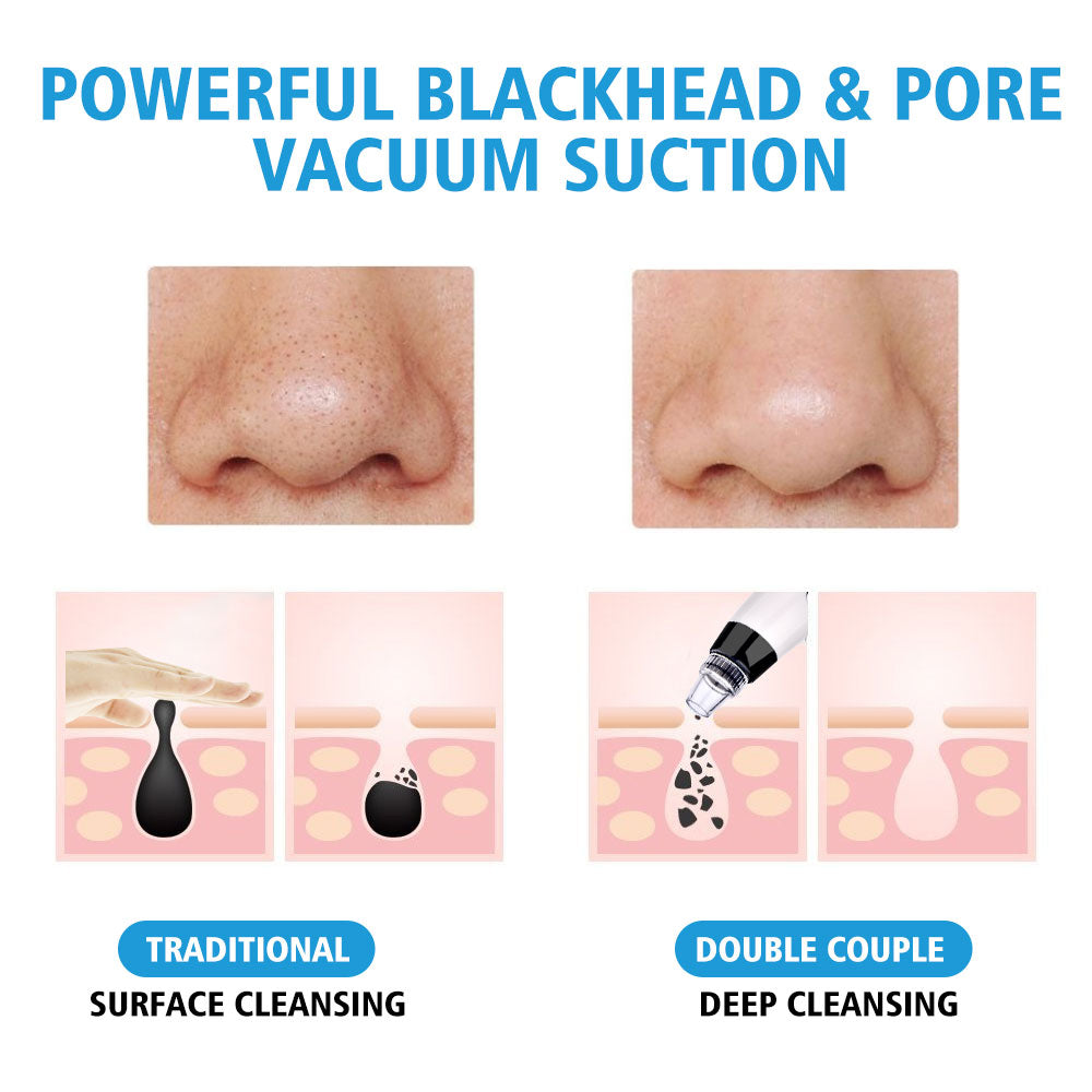 4-in-1 Blackhead Remover & Pore Vacuum Cleaner | Deep Cleansing with Multiple Probes | Cordless & Portable